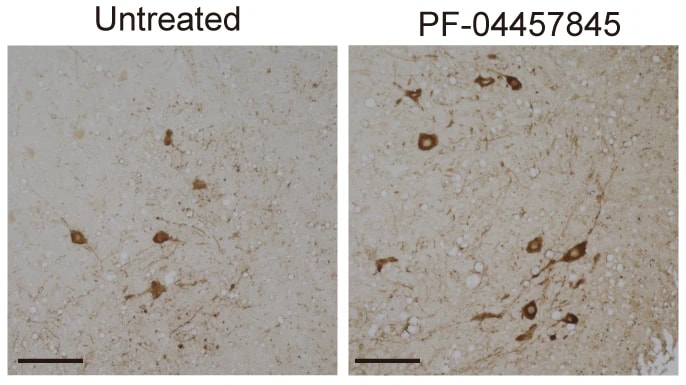 Compound already safety tested in humans slowed ALS progression in mice preview image