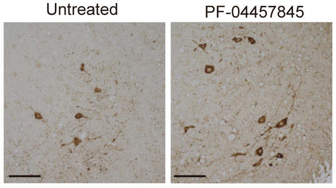 Human blood marker points to a compound that slows ALS in mice | News & Events | Nagoya University preview image