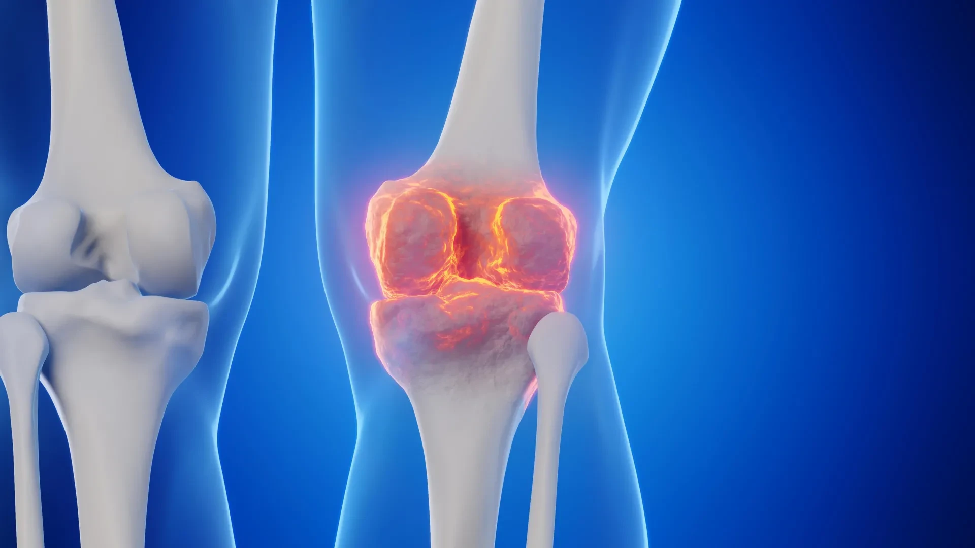 Goodbye joint replacements? Stanford scientists found a way to regrow cartilage and stop arthritis preview image